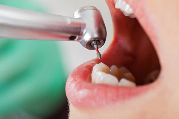 Best Weekend Emergency Dentist in Hanover, IN
